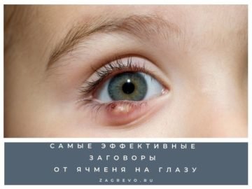 Как вывести ячмень на глазу.